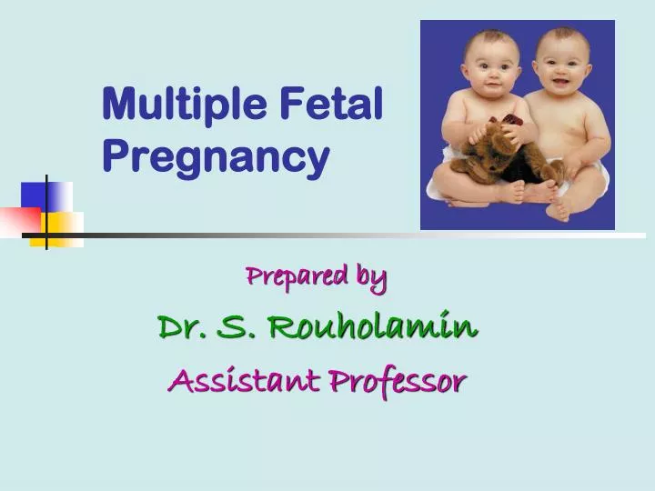 PPT - Multiple Fetal Pregnancy PowerPoint Presentation, Free Download ...