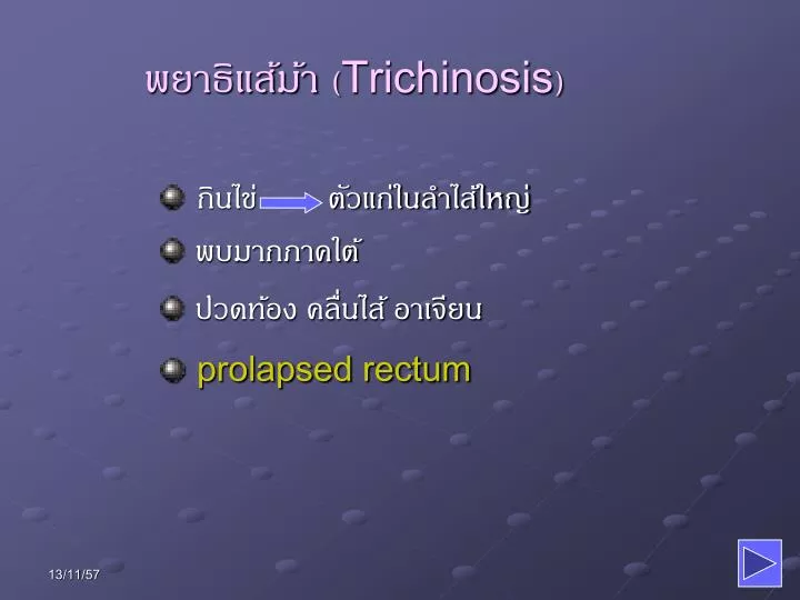 trichinosis