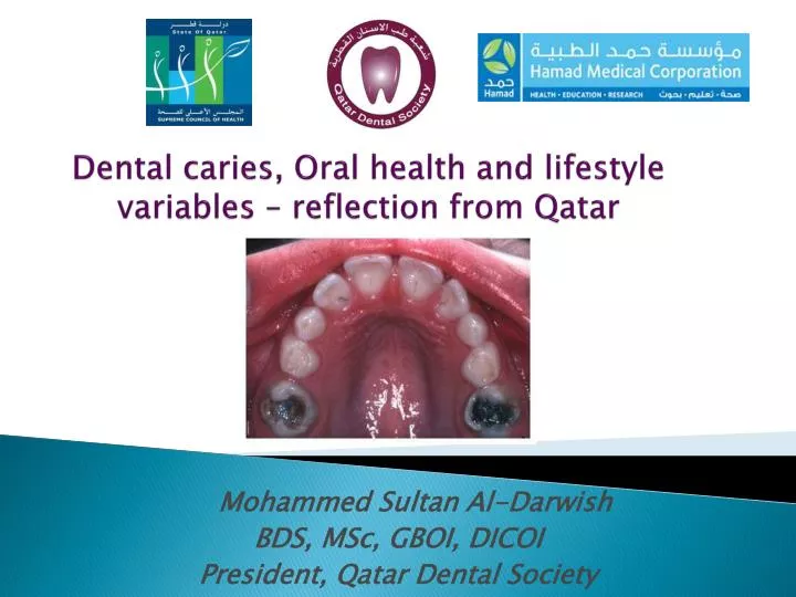 dental caries oral health and lifestyle variables reflection from qatar