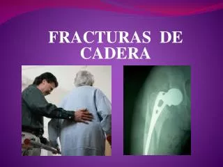 fracturas de cadera