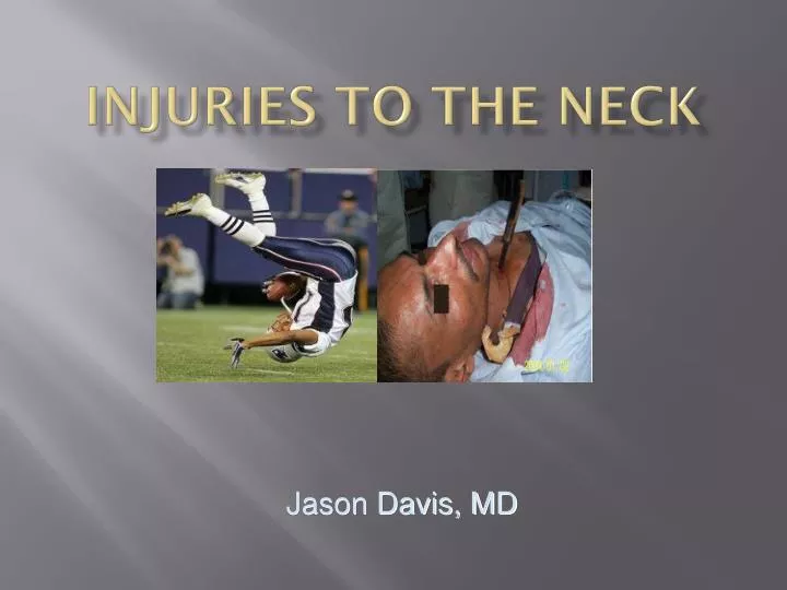 injuries to the neck