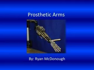 Prosthetic Arms