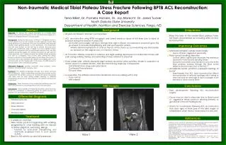 Non-traumatic Medical Tibial Plateau Stress Fracture Following BPTB ACL Reconstruction: