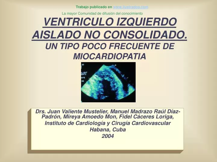 ventriculo izquierdo aislado no consolidado un tipo poco frecuente de miocardiopatia
