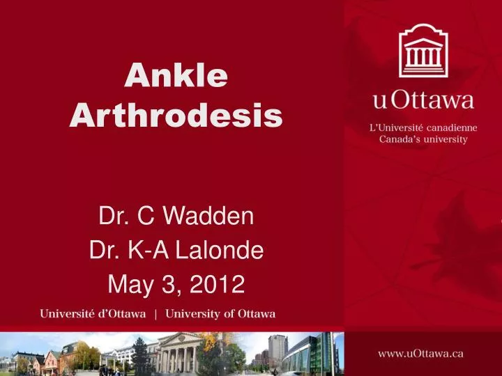ankle arthrodesis