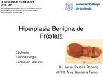Hiperplasia Benigna de Próstata - slide 1
