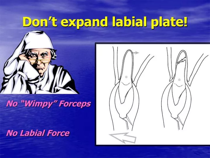 don t expand labial plate
