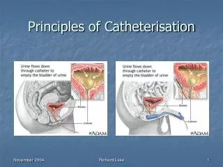 Principles of Catheterisation