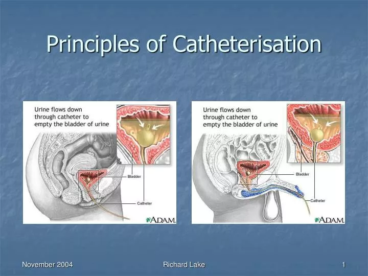 principles of catheterisation