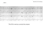 ECG 1 - slide 1