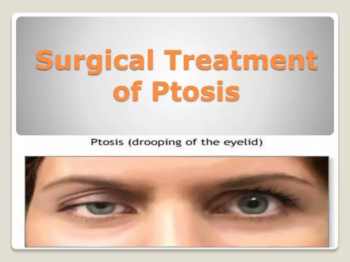 surgical treatment of ptosis
