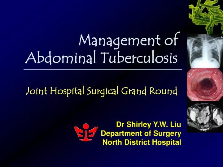 management of abdominal tuberculosis joint hospital surgical grand round