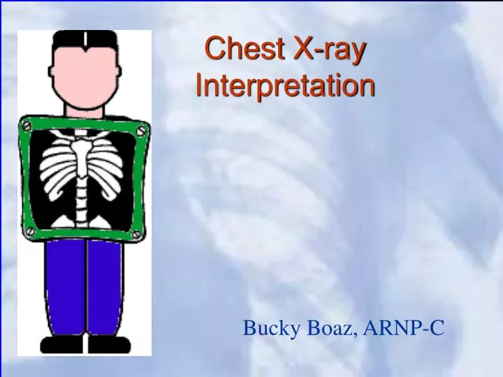 chest x ray interpretation