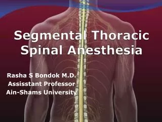 Segmental Thoracic Spinal Anesthesia