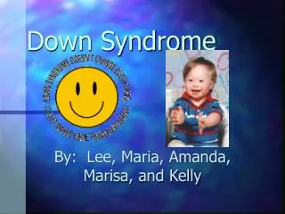 Down Syndrome