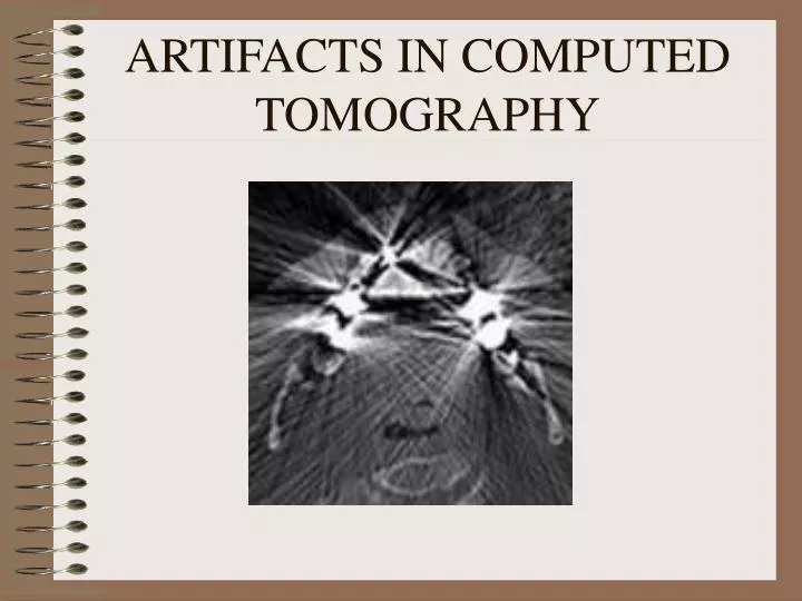 artifacts in computed tomography
