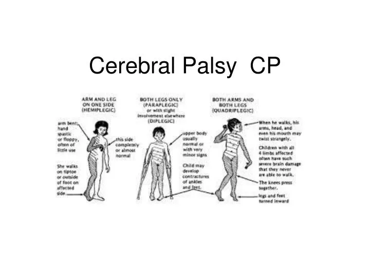 cerebral palsy cp