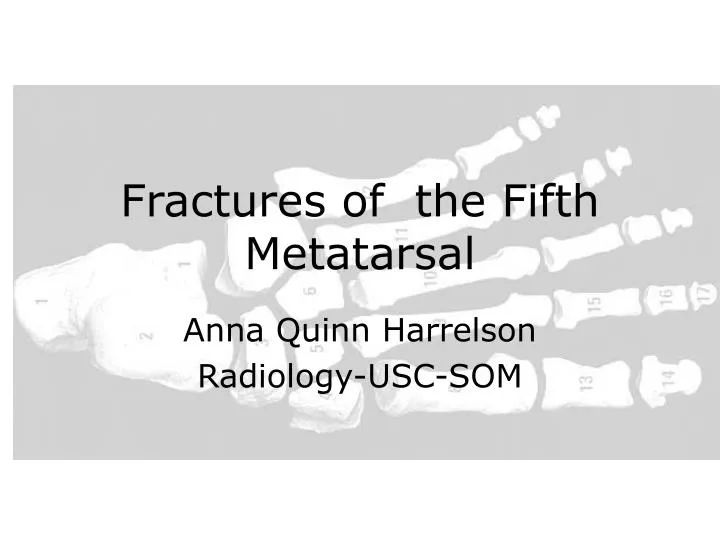 fractures of the fifth metatarsal