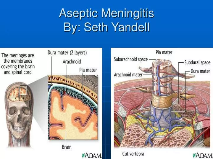 aseptic meningitis by seth yandell