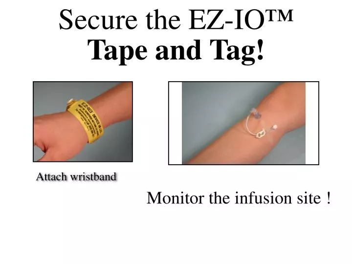 secure the ez io tape and tag