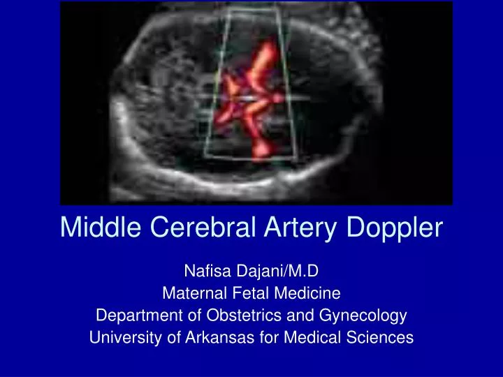 middle cerebral artery doppler