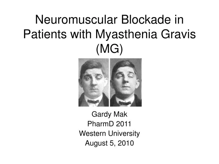 Ppt Neuromuscular Blockade In Patients With Myasthenia Gravis Mg Powerpoint Presentation 2600