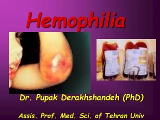 Hemophilia Dr. Pupak Derakhshandeh (PhD) Assis. Prof. Med. Sci. of Tehran Univ .