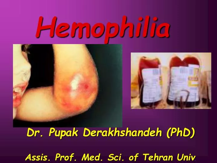hemophilia dr pupak derakhshandeh phd assis prof med sci of tehran univ