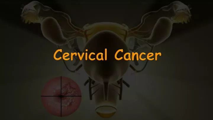 cervical c ancer