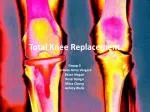 Total Knee Replacement - slide 1