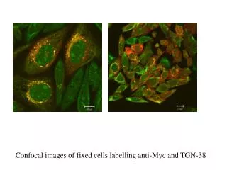 Confocal images of fixed cells labelling anti-Myc and TGN-38