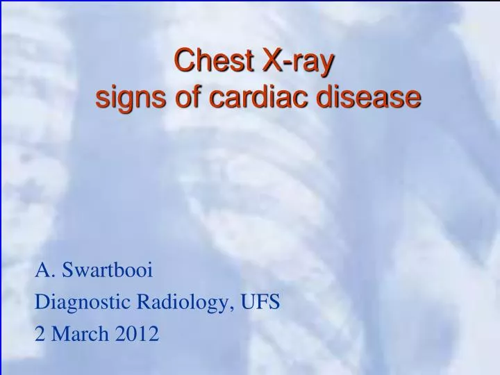 chest x ray signs of cardiac disease