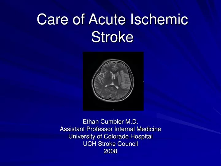 care of acute ischemic stroke