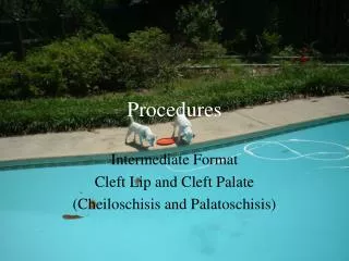 Procedures