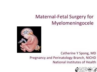 Maternal-Fetal Surgery for Myelomeningocele