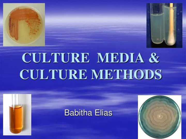 culture media culture methods