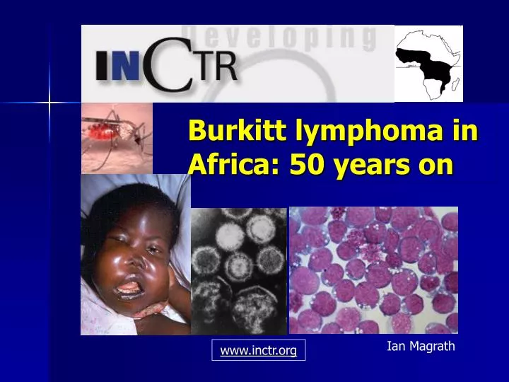 burkitt lymphoma in africa 50 years on
