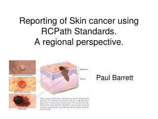 Reporting of Skin cancer using RCPath Standards. A regional perspective.