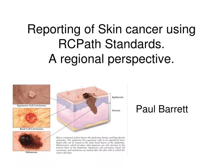 reporting of skin cancer using rcpath standards a regional perspective