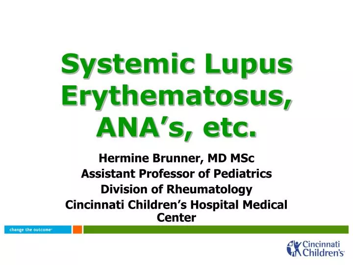 systemic lupus erythematosus ana s etc