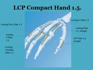 LCP Compact Hand 1.5.