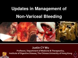 Justin CY Wu Professor, Department of Medicine &amp; Therapeutics,
