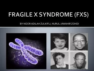 FRAGILE X SYNDROME (FXS)