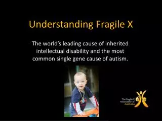 Understanding Fragile X