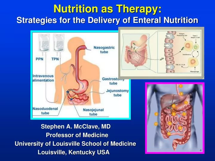 nutrition as therapy strategies for the delivery of enteral nutrition