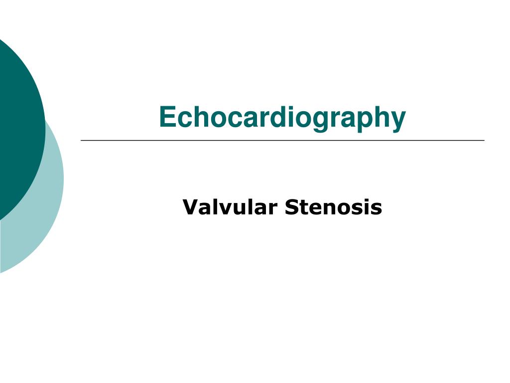 PPT - Echocardiography PowerPoint Presentation, free download - ID:6644817