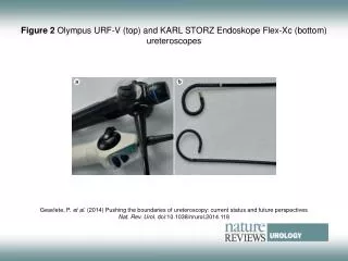 Figure 2 Olympus URF?V (top) and KARL STORZ Endoskope Flex-Xc (bottom) ureteroscopes