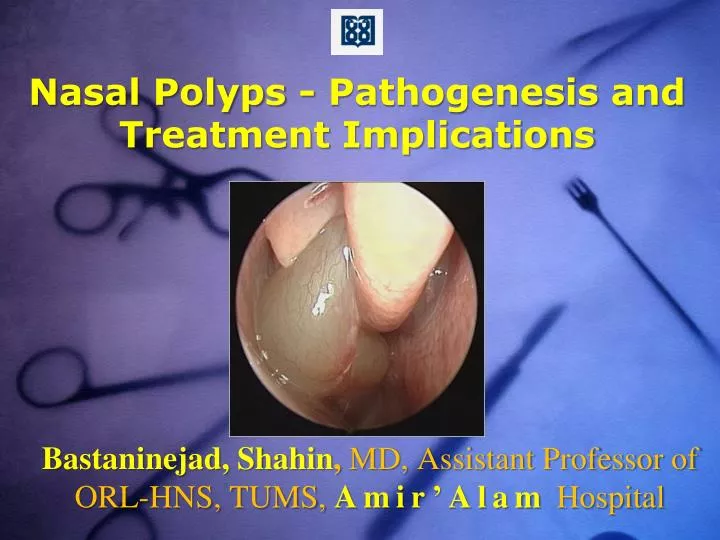 nasal polyps pathogenesis and treatment implications