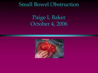 Small Bowel Obstruction Paige L Baker October 4, 2006
