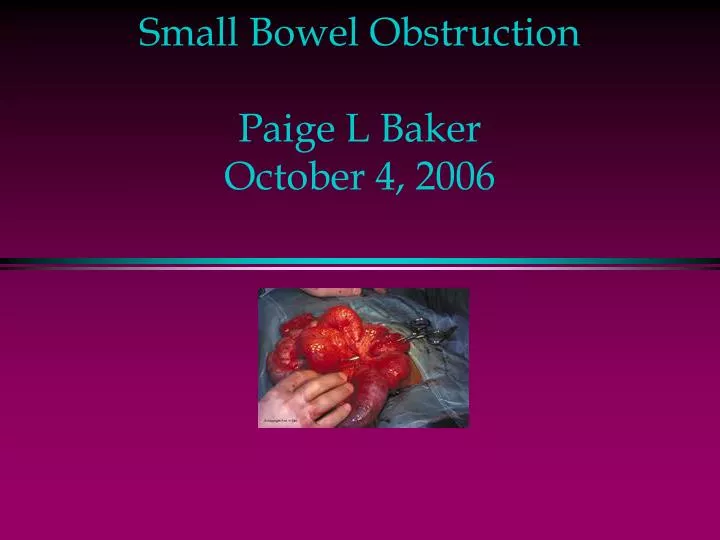 small bowel obstruction paige l baker october 4 2006